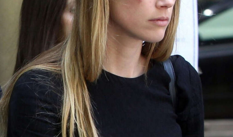 Amber Heard Visibly Bruised Leaves Court Los Angeles (9 photos)