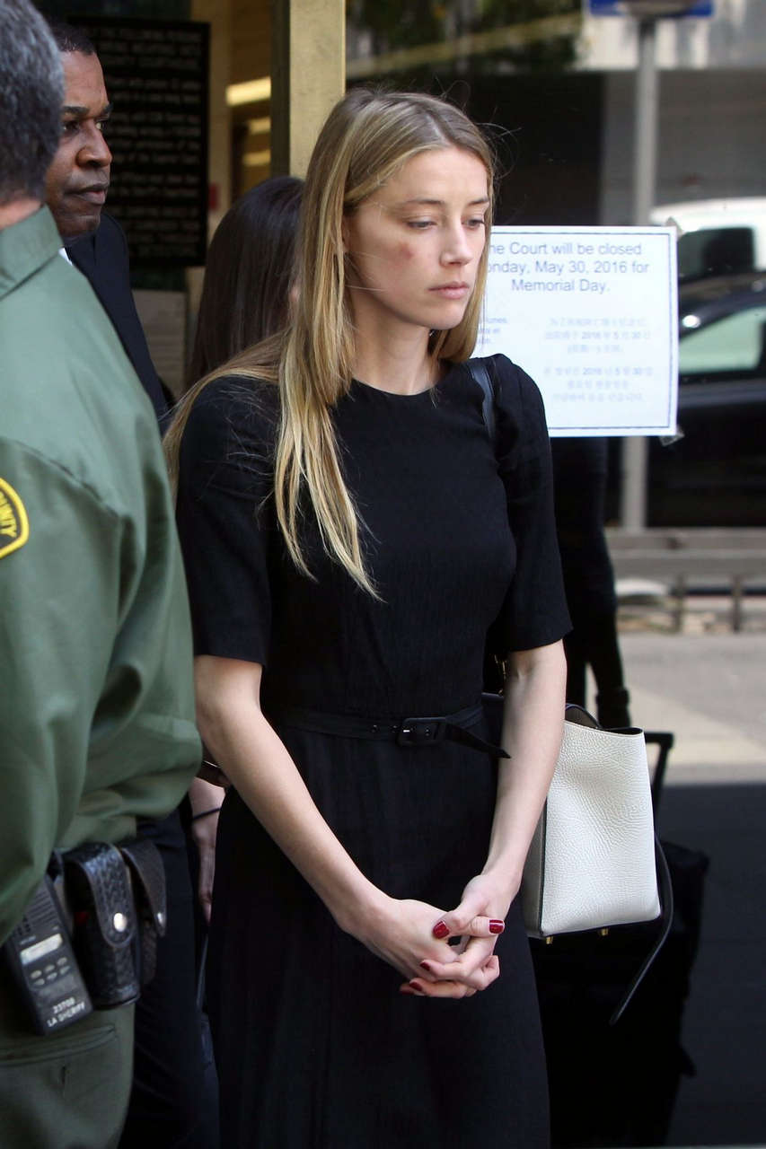 Amber Heard Visibly Bruised Leaves Court Los Angeles