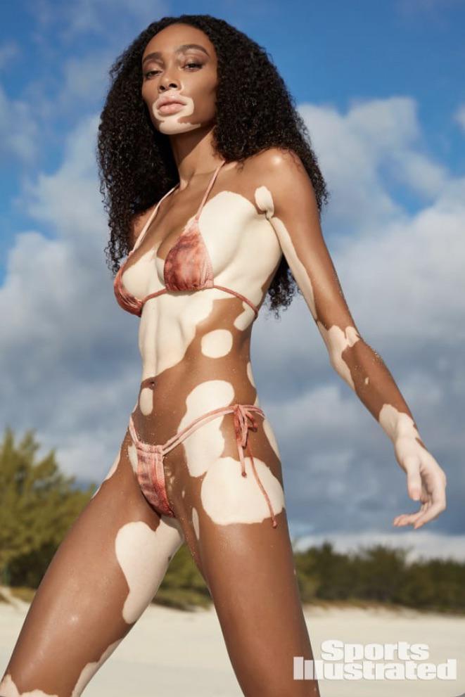 Winnie Harlow Hot